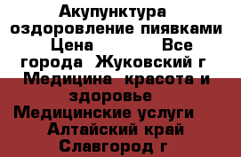 Акупунктура, оздоровление пиявками › Цена ­ 3 000 - Все города, Жуковский г. Медицина, красота и здоровье » Медицинские услуги   . Алтайский край,Славгород г.